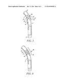 TRACHEOSTOMY TUBES diagram and image