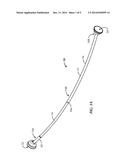 ADJUSTABLE TENSION-MOUNTED CURVED ROD ASSEMBLY diagram and image