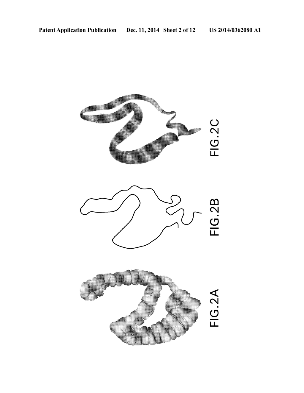 System and Method for Context Preserving Maps Of Tubular Structures - diagram, schematic, and image 03