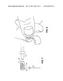 APPARATUS FOR EVACUATION OF ROOT CANAL diagram and image