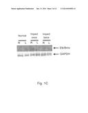 METHOD FOR DETECTING AND EXAMINING TRAUMATIC BRAIN INJURY IN VITRO diagram and image