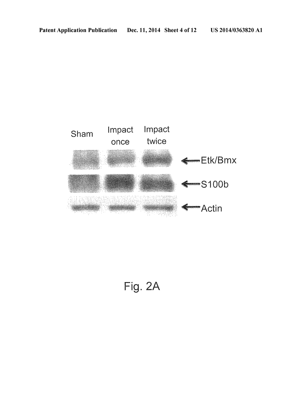 METHOD FOR DETECTING AND EXAMINING TRAUMATIC BRAIN INJURY IN VITRO - diagram, schematic, and image 05