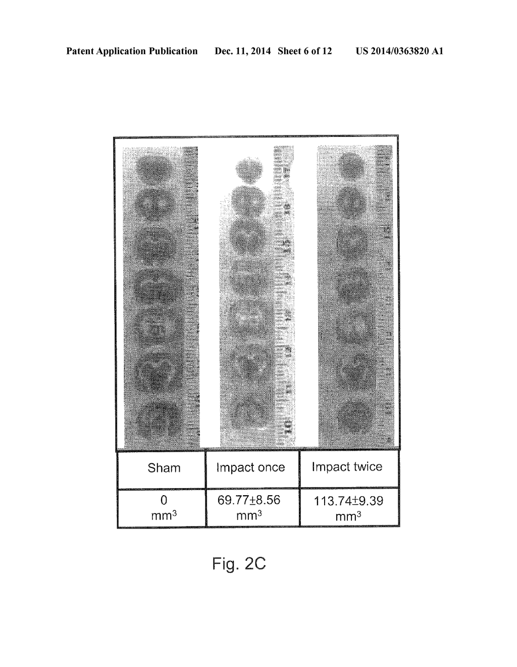 METHOD FOR DETECTING AND EXAMINING TRAUMATIC BRAIN INJURY IN VITRO - diagram, schematic, and image 07