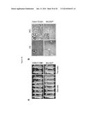 RECURRENT GENE FUSIONS IN PROSTATE CANCER diagram and image