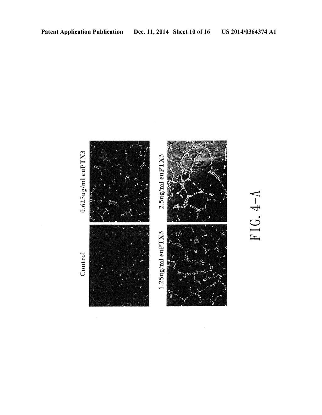 AMINO ACID SEQUENCE FOR INHIBITING PTX3 TO TREAT NASOPHARYNGEAL CARCINOMA - diagram, schematic, and image 11