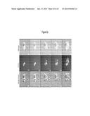 ASSAY FOR SCREENING COMPOUNDS THAT SELECTIVELY DECREASE THE NUMBER OF     CANCER STEM CELLS diagram and image