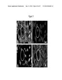 ASSAY FOR SCREENING COMPOUNDS THAT SELECTIVELY DECREASE THE NUMBER OF     CANCER STEM CELLS diagram and image