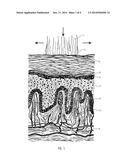 HIGHLY PENETRATING COMPOSITIONS AND METHODS FOR TREATING DISORDERED     TISSUES diagram and image