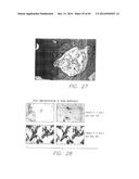 PSCA: PROSTATE STEM CELL ANTIGEN AND USES THEREOF diagram and image