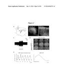 IN VIVO VISUALIZATION AND CONTROL OF PATHOLIGICAL CHANGES IN NEURAL     CIRCUITS diagram and image