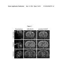 IN VIVO VISUALIZATION AND CONTROL OF PATHOLIGICAL CHANGES IN NEURAL     CIRCUITS diagram and image