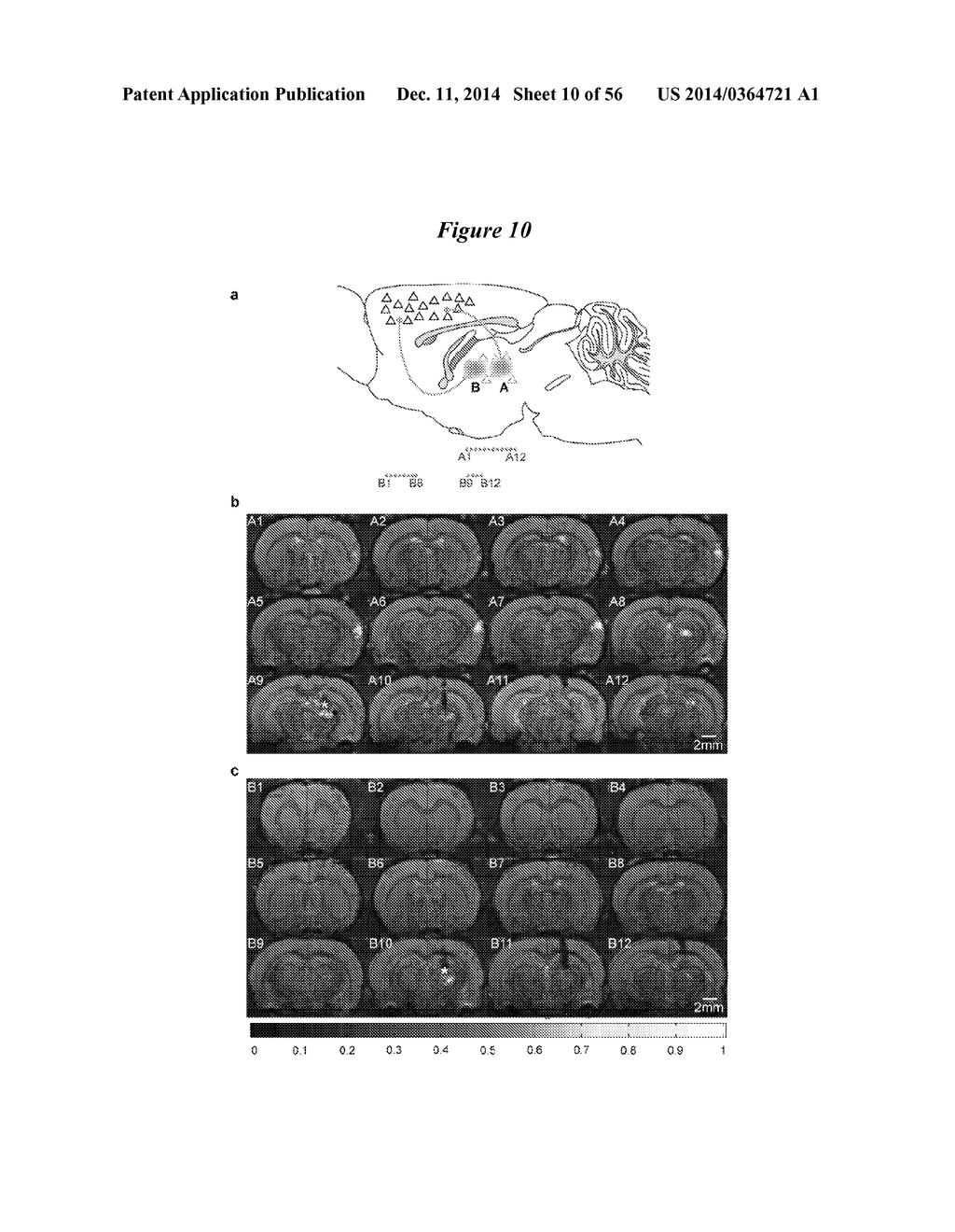 IN VIVO VISUALIZATION AND CONTROL OF PATHOLIGICAL CHANGES IN NEURAL     CIRCUITS - diagram, schematic, and image 11