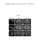 IN VIVO VISUALIZATION AND CONTROL OF PATHOLIGICAL CHANGES IN NEURAL     CIRCUITS diagram and image