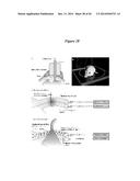 IN VIVO VISUALIZATION AND CONTROL OF PATHOLIGICAL CHANGES IN NEURAL     CIRCUITS diagram and image