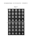 IN VIVO VISUALIZATION AND CONTROL OF PATHOLIGICAL CHANGES IN NEURAL     CIRCUITS diagram and image