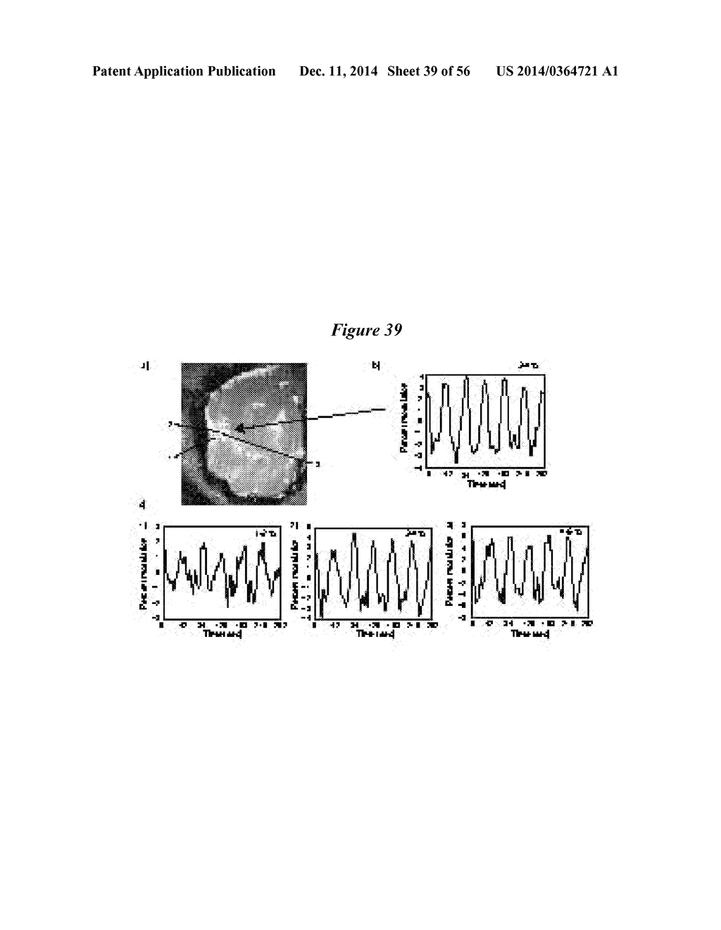 IN VIVO VISUALIZATION AND CONTROL OF PATHOLIGICAL CHANGES IN NEURAL     CIRCUITS - diagram, schematic, and image 40