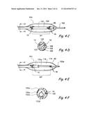 SYSTEMS AND METHODS FOR PERFORMING IMAGE GUIDED PROCEDURES WITHIN THE EAR,     NOSE, THROAT AND PARANASAL SINUSES diagram and image