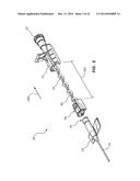 PORTED IV CATHETER HAVING EXTERNAL NEEDLE SHIELD AND INTERNAL BLOOD     CONTROL SEPTUM diagram and image