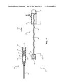 PORTED IV CATHETER HAVING EXTERNAL NEEDLE SHIELD AND INTERNAL BLOOD     CONTROL SEPTUM diagram and image