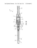 PORTED IV CATHETER HAVING EXTERNAL NEEDLE SHIELD AND INTERNAL BLOOD     CONTROL SEPTUM diagram and image