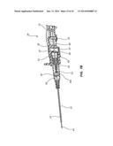 PORTED IV CATHETER HAVING EXTERNAL NEEDLE SHIELD AND INTERNAL BLOOD     CONTROL SEPTUM diagram and image