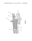 PORTED IV CATHETER HAVING EXTERNAL NEEDLE SHIELD AND INTERNAL BLOOD     CONTROL SEPTUM diagram and image