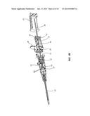 PORTED IV CATHETER HAVING EXTERNAL NEEDLE SHIELD AND INTERNAL BLOOD     CONTROL SEPTUM diagram and image