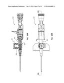 PORTED IV CATHETER HAVING EXTERNAL NEEDLE SHIELD AND INTERNAL BLOOD     CONTROL SEPTUM diagram and image