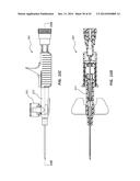 PORTED IV CATHETER HAVING EXTERNAL NEEDLE SHIELD AND INTERNAL BLOOD     CONTROL SEPTUM diagram and image