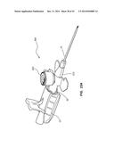 PORTED IV CATHETER HAVING EXTERNAL NEEDLE SHIELD AND INTERNAL BLOOD     CONTROL SEPTUM diagram and image