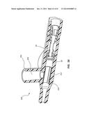 PORTED IV CATHETER HAVING EXTERNAL NEEDLE SHIELD AND INTERNAL BLOOD     CONTROL SEPTUM diagram and image