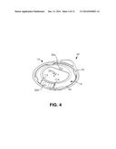 CONTROLLED DISCHARGE OSTOMY APPLIANCE AND SHIELD THEREFOR diagram and image