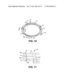 CONTROLLED DISCHARGE OSTOMY APPLIANCE AND SHIELD THEREFOR diagram and image