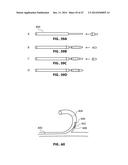 DEVICE AND METHODS FOR TRANSVASCULAR TUMOR EMBOLIZATION WITH INTEGRATED     FLOW REGULATION diagram and image