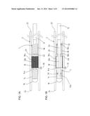 PUSHER GUIDEWIRE diagram and image