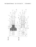 PUSHER GUIDEWIRE diagram and image