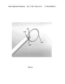 ENDOSCOPIC SNARE DEVICE diagram and image