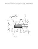 ENDOSCOPIC SNARE DEVICE diagram and image