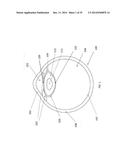 METHOD, APPARATUS, AND A SYSTEM FOR ROBOTIC ASSISTED CATARACT SURGERY diagram and image