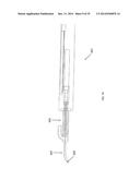 METHOD, APPARATUS, AND A SYSTEM FOR ROBOTIC ASSISTED CATARACT SURGERY diagram and image