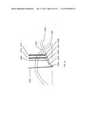 METHOD, APPARATUS, AND A SYSTEM FOR ROBOTIC ASSISTED CATARACT SURGERY diagram and image