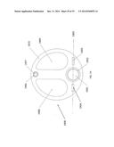 METHOD, APPARATUS, AND A SYSTEM FOR ROBOTIC ASSISTED CATARACT SURGERY diagram and image