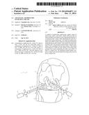 ATRAUMATIC ARTHROSCOPIC INSTRUMENT SHEATH diagram and image