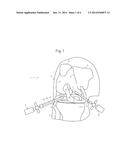 ATRAUMATIC ARTHROSCOPIC INSTRUMENT SHEATH diagram and image