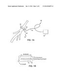 NERVE CUFF FOR IMPLANTABLE ELECTRODE diagram and image