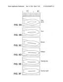 NERVE CUFF FOR IMPLANTABLE ELECTRODE diagram and image