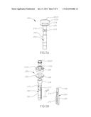 COMPRESSION ANASTOMOSIS RING AND SENSOR SYSTEM diagram and image