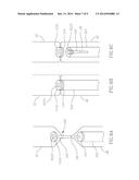 COMPRESSION ANASTOMOSIS RING AND SENSOR SYSTEM diagram and image