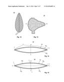 Restricted Expansion Dissector diagram and image