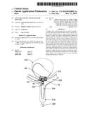 EXCLUSION DEVICE AND SYSTEM FOR DELIVERY diagram and image